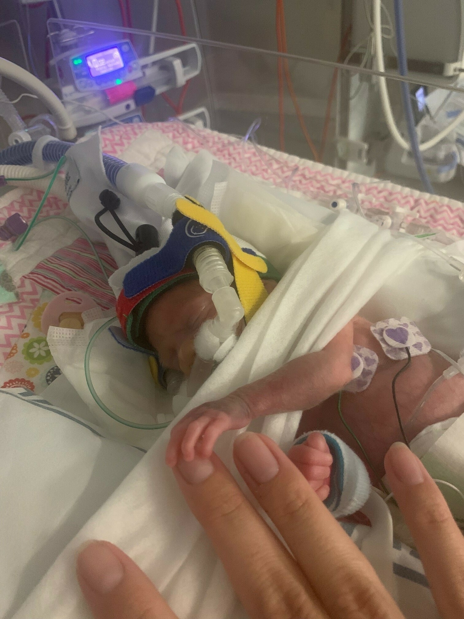 Results from The New Zealand Very Low Birthweight (VLBW) Study